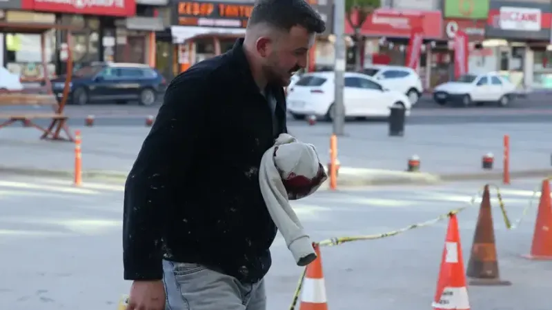 Acemi kasaplar hastanelik oldu